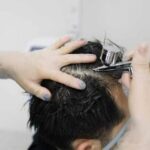 Hair Loss Treatment Methods Choosing the Right Approach for You 