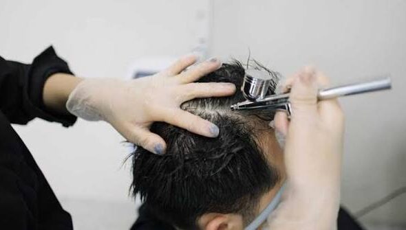 Hair Loss Treatment Methods Choosing the Right Approach for You 