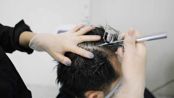 Hair Loss Treatment Methods Choosing the Right Approach for You 